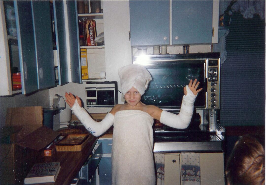A person stands in a kitchen with both arms in casts and wrapped in a towel, with another towel wrapped on their head, smiling and holding their arms up. The kitchen has blue cabinets and various appliances visible.