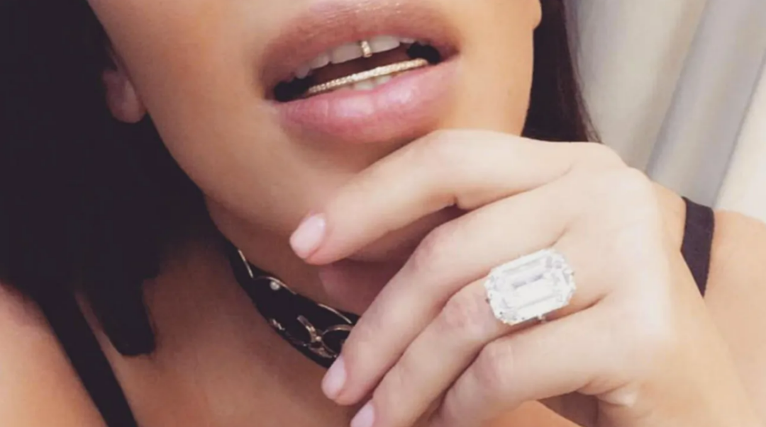 A close-up of a woman's mouth and hand, showing a gold grill on her lower teeth, a large rectangular diamond ring on her finger, nude lipstick, and a black choker necklace.