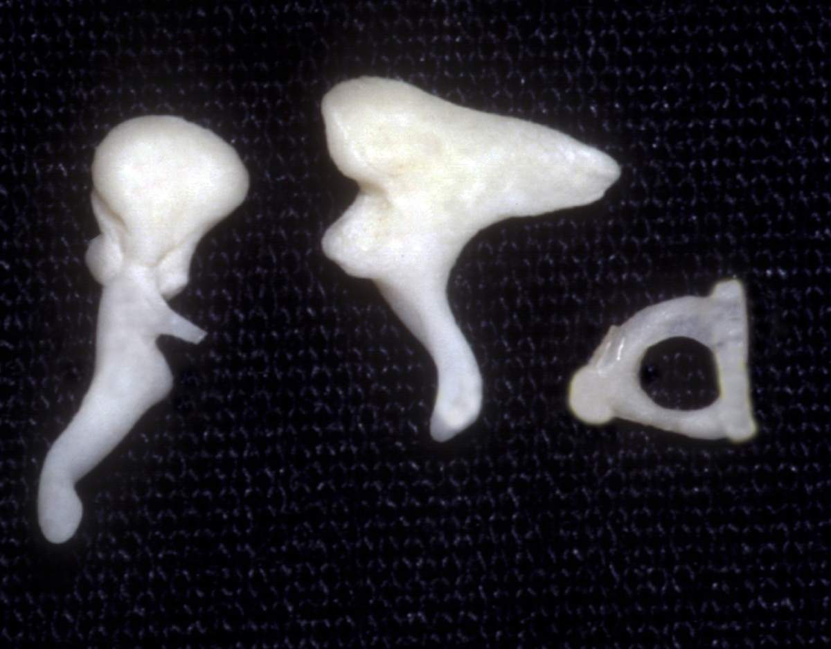 Three small, white middle ear bones—the malleus, incus, and stapes—are displayed on a dark textured background. Each bone has a distinct shape and size.