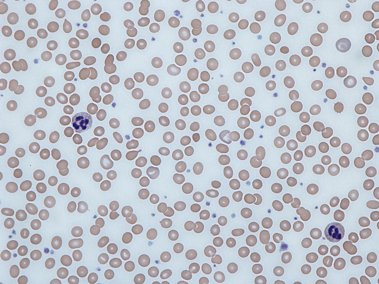 Microscopic view of human blood smear showing many round red blood cells and a few purple-stained white blood cells scattered throughout on a light background.
