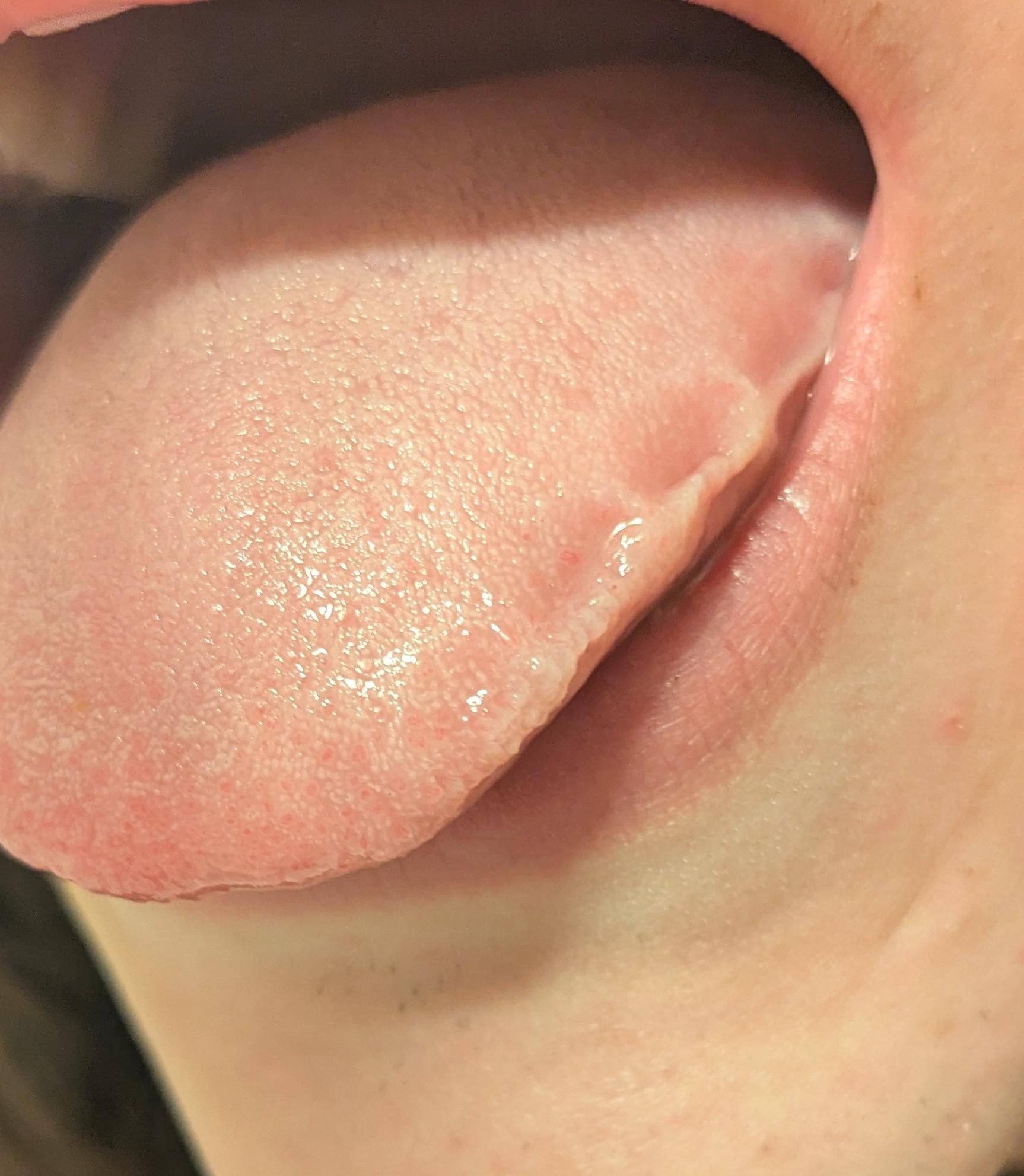 A close-up image of a person's mouth with their tongue extended outward, showing the texture and surface of the tongue.