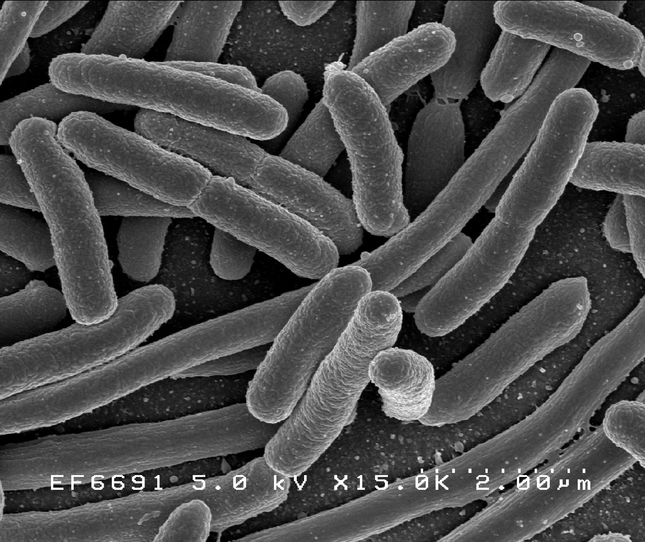 Black and white microscope image showing numerous rod-shaped bacteria crowded together. The bacterial cells have a textured surface and are different lengths, with some overlapping or lying next to each other. Scientific scale and data are visible.