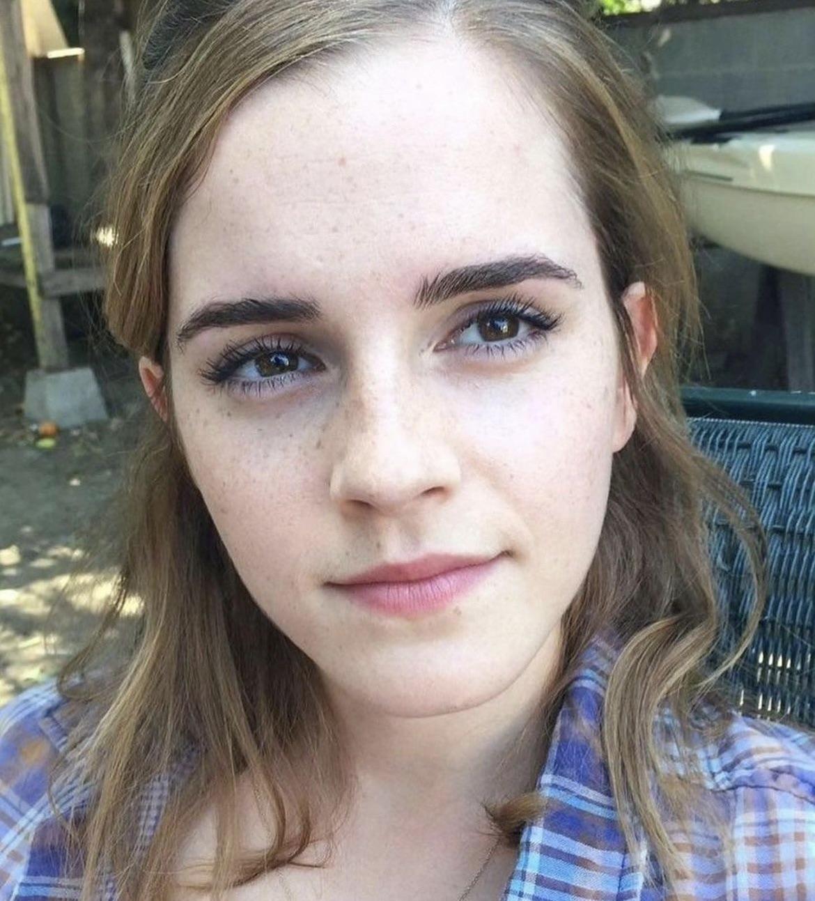 A young woman with light brown hair and fair skin sits outdoors, looking directly at the camera. She wears a plaid shirt and has a gentle expression, with sunlight softly illuminating her face.