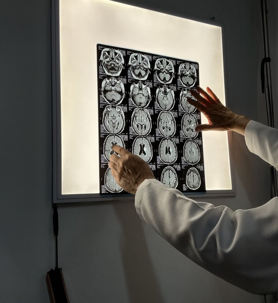 A person in a white coat adjusts a brain MRI scan sheet on a lightbox, with their hands holding the edges and the images illuminated from behind.