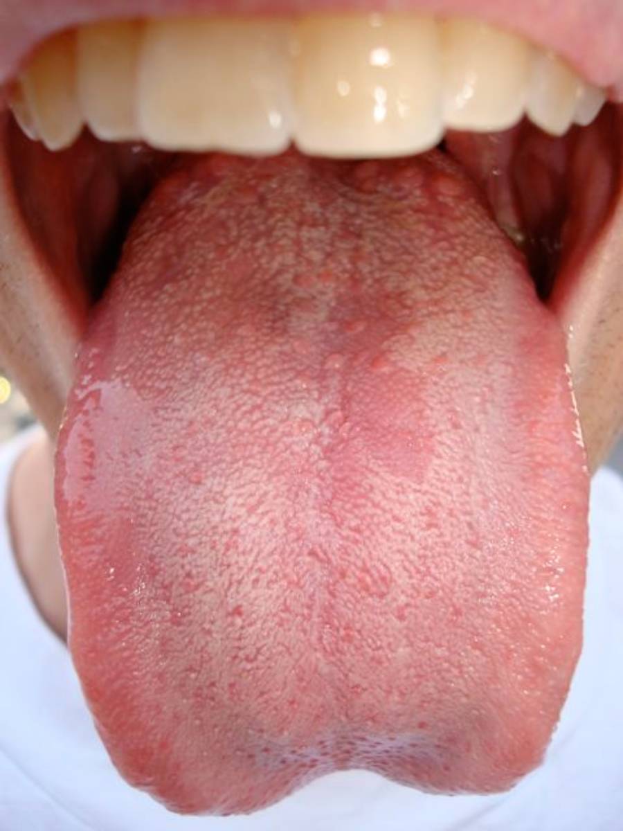 Close-up of an open mouth with the tongue sticking out, showing the surface texture of the tongue and upper teeth.