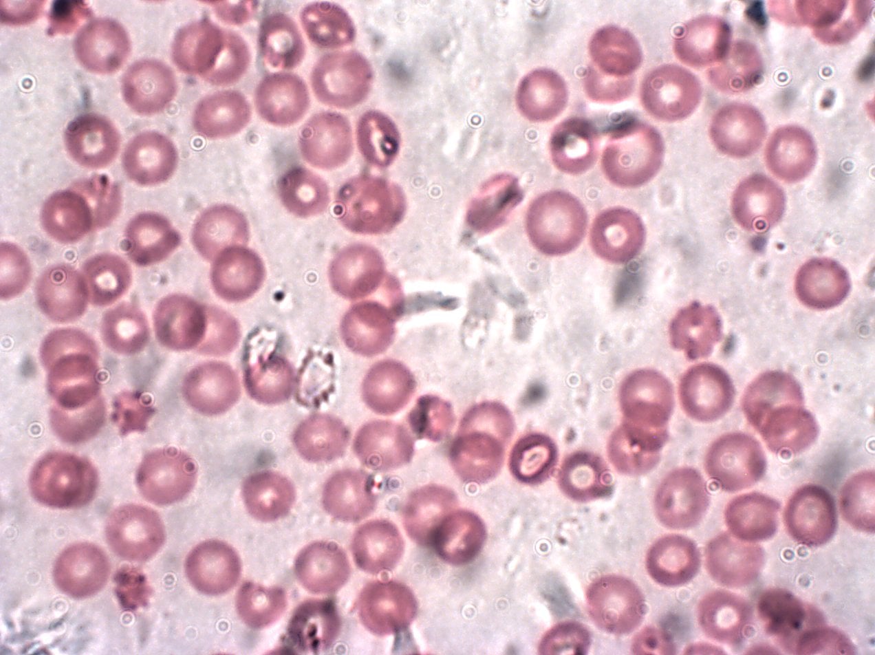Microscopic view of numerous round, pinkish-red blood cells scattered across a light background, with a few white blood cells visible among them.