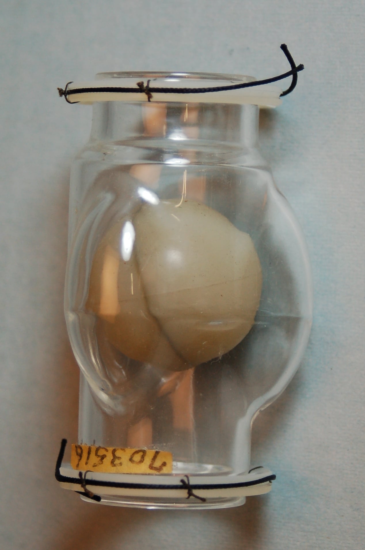A preserved specimen of an eyeball in a clear glass jar with black wires and a yellow label marked “703616” attached to the jar.