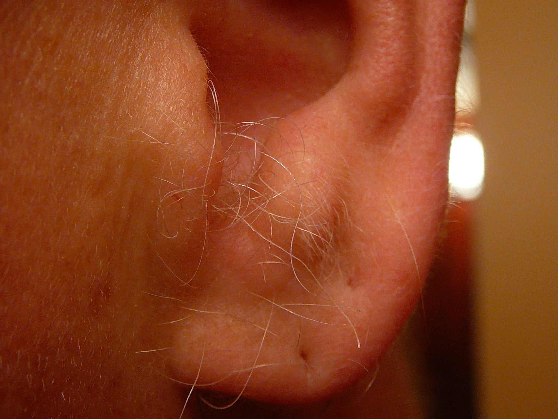 Close-up of a human ear with several long, white hairs growing from the earlobe and the area around the ear. The skin appears light and the background is out of focus.